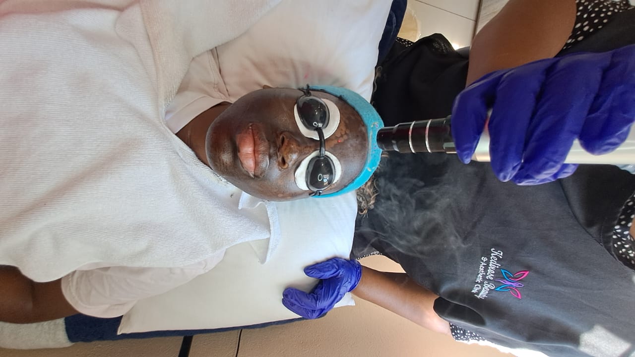 Skin Treatments