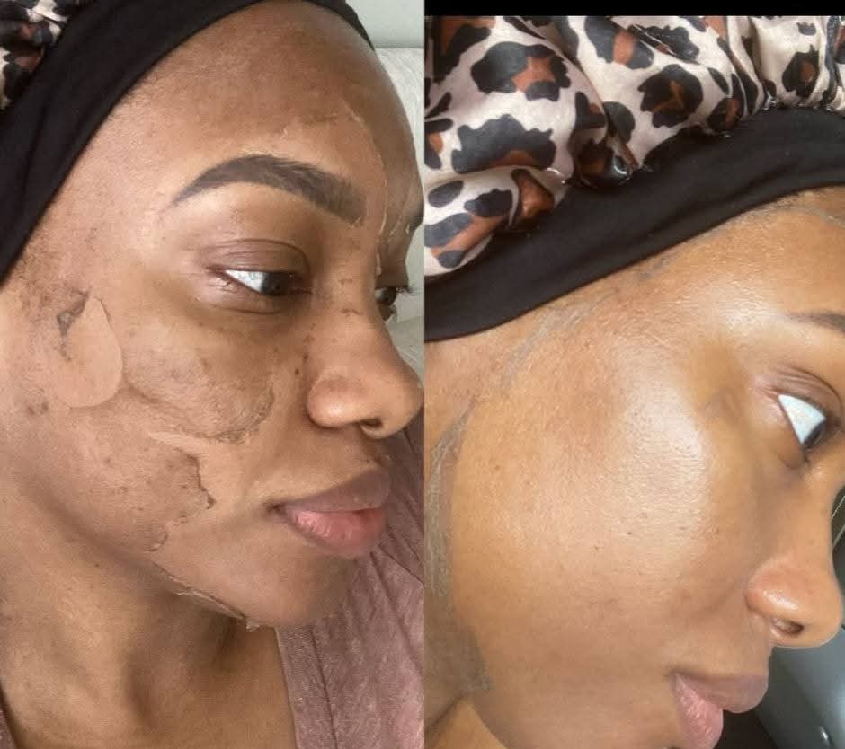 Skin Treatments at Kedirose Beauty Clinic Kempton Park